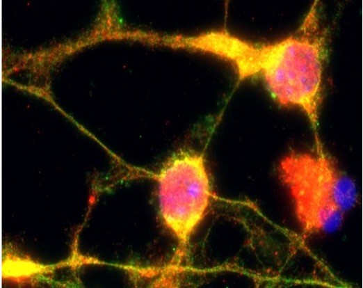 UCI biomedical researchers used mass spectroscopy to look at fluid samples from people with early AD to determine how much of a potential drug treatment reached the blood and the brain. 